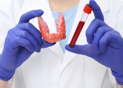 Diagnosis Of Thyroid Disorder In Indore By Dr. Abhyudaya Verma