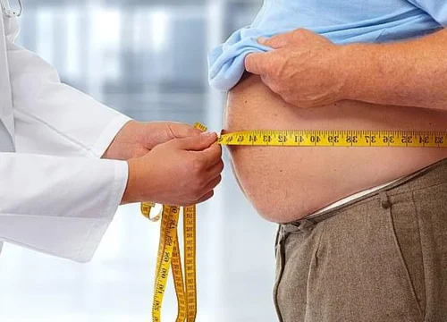 Obesity (1) Obesity (1)
