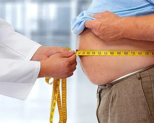 Obesity (1)